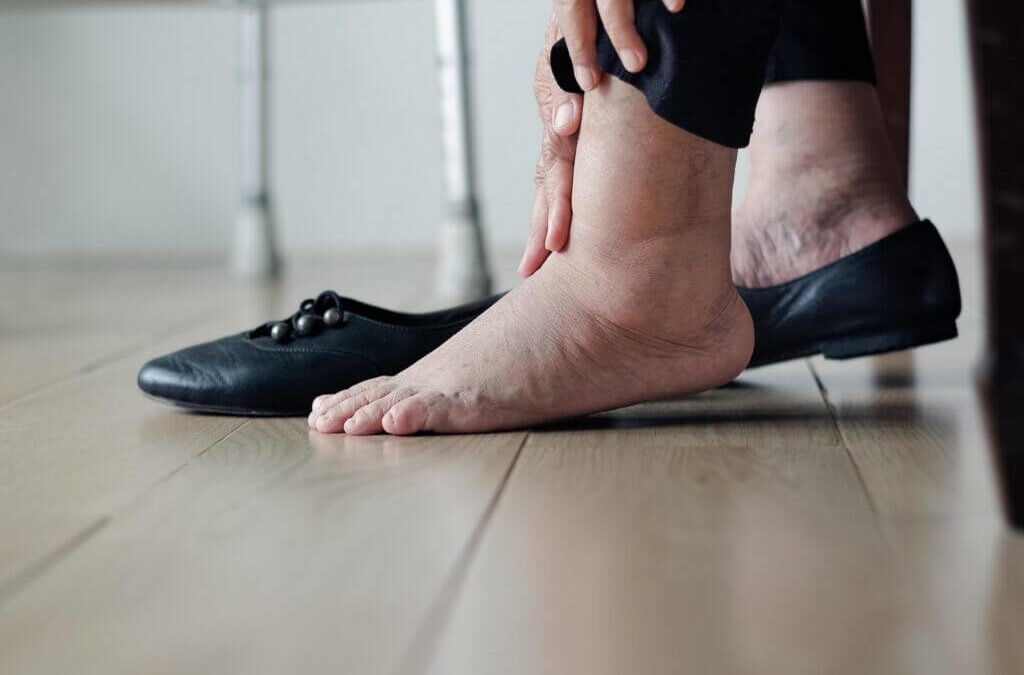 Comment maigrir des chevilles ?