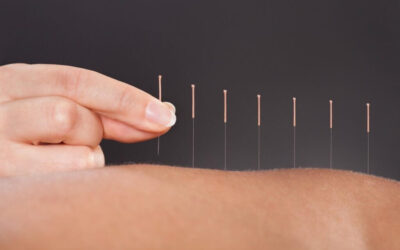 En quoi l’acupuncture est-elle efficace pour la perte de poids ?