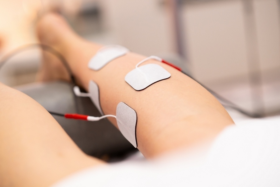 Combo électrostimulation - cryolipolyse electrostimulation cryolipolyse