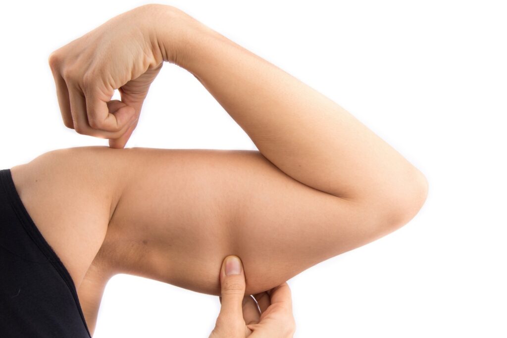 Cryolipolyse bras