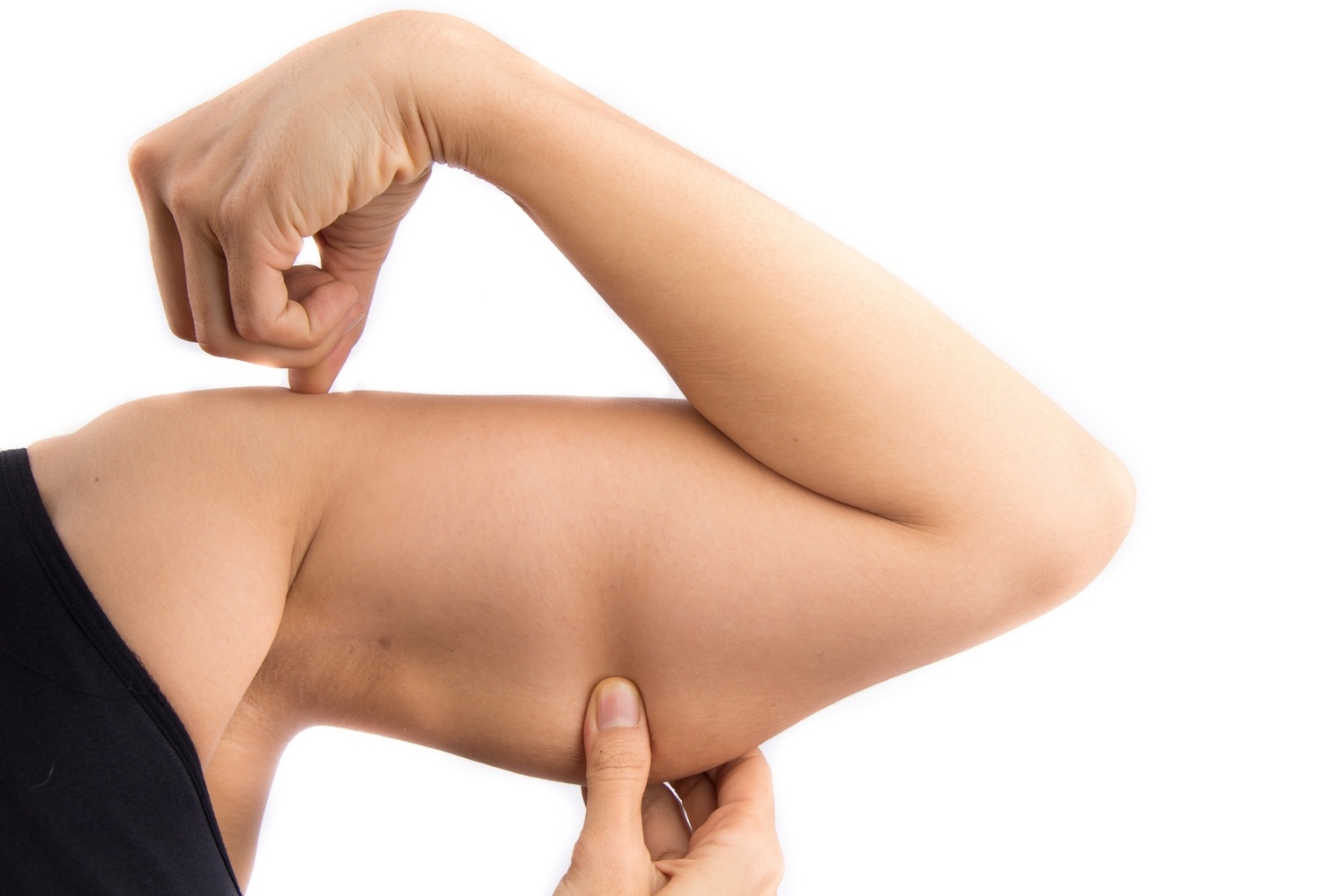 Cryolipolyse des bras : tout savoir