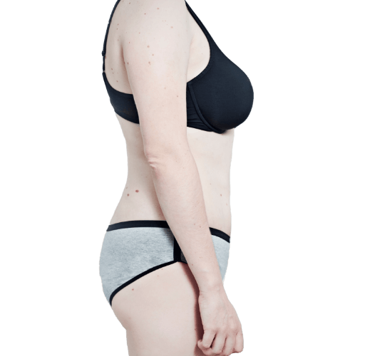 After image